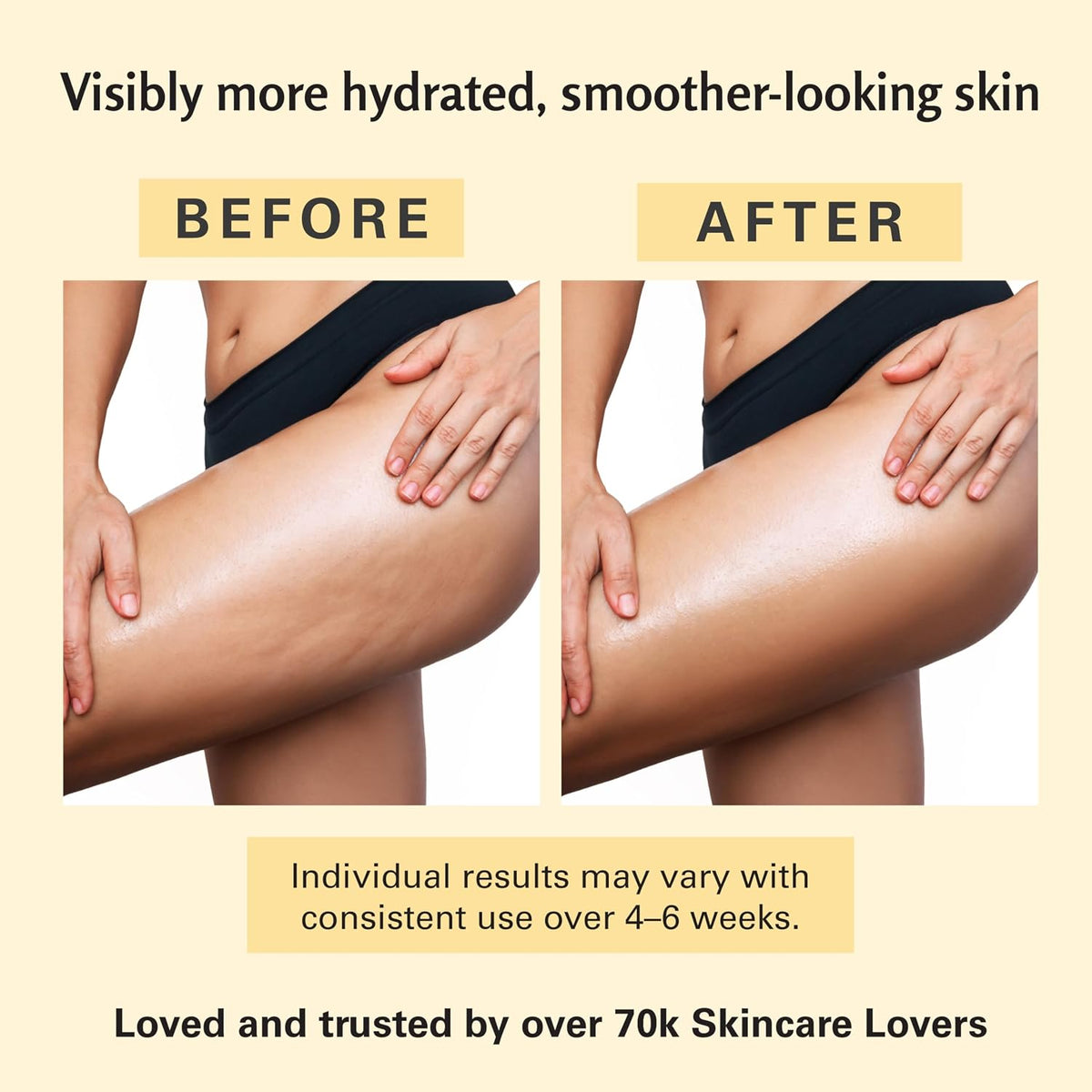 Anti Cellulite Massage Oil for Massage Therapy with Collagen (8 Fl Oz)